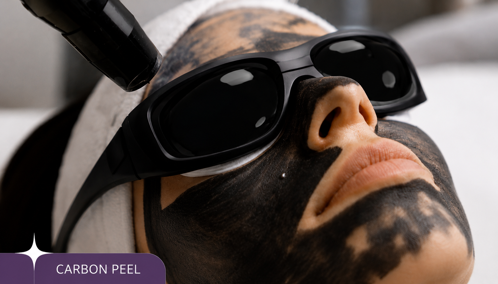 carboon-peel