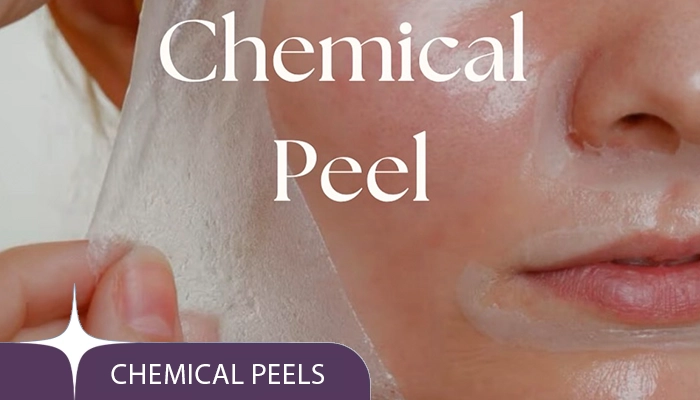 Chemical Peels Treatment in dubai at nour clinic